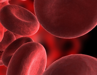 Sickle-cell anaemia